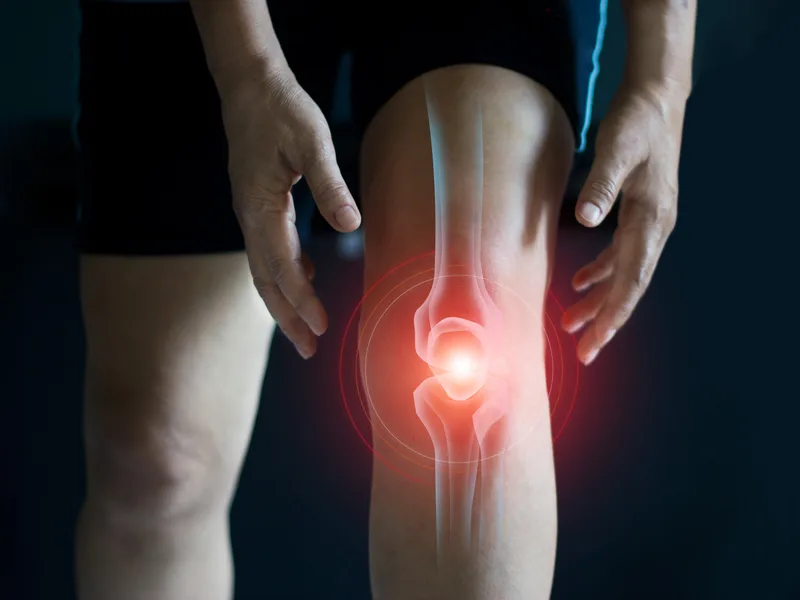 How The Creek Chiropractic & Wellness treats arthritis in Battle Creek